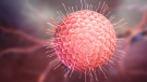 Impredecible y dolorosa... Herpes Zóster, la enfermedad que llega sin avisar, incluso a las celebridades