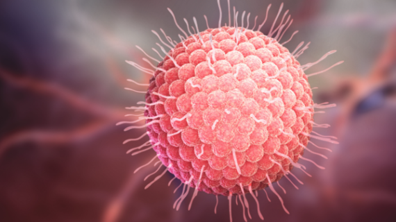 Impredecible y dolorosa... Herpes Zóster, la enfermedad que llega sin avisar, incluso a las celebridades
